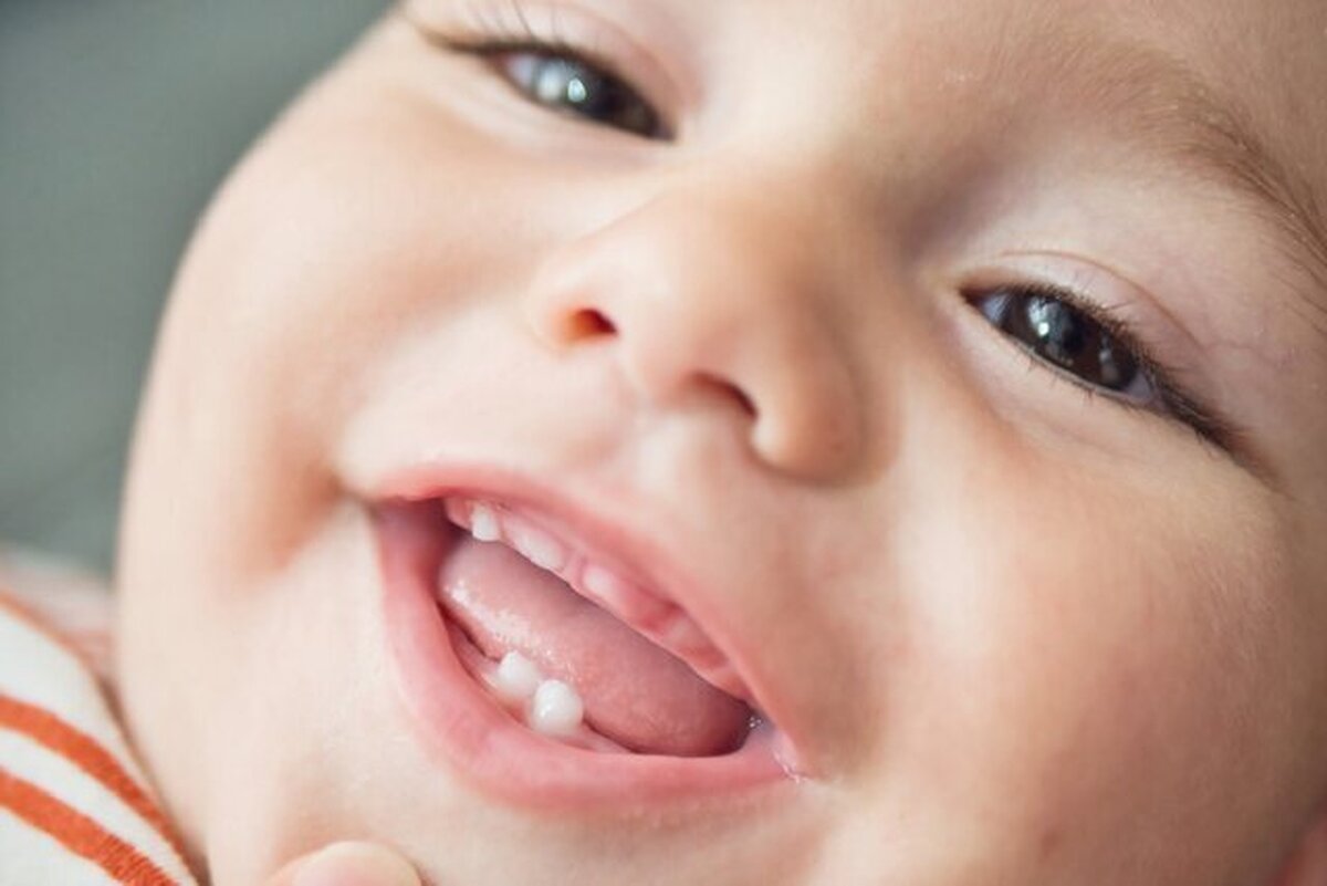 دندان‌ این نوزادان زودتر درمی‌آید