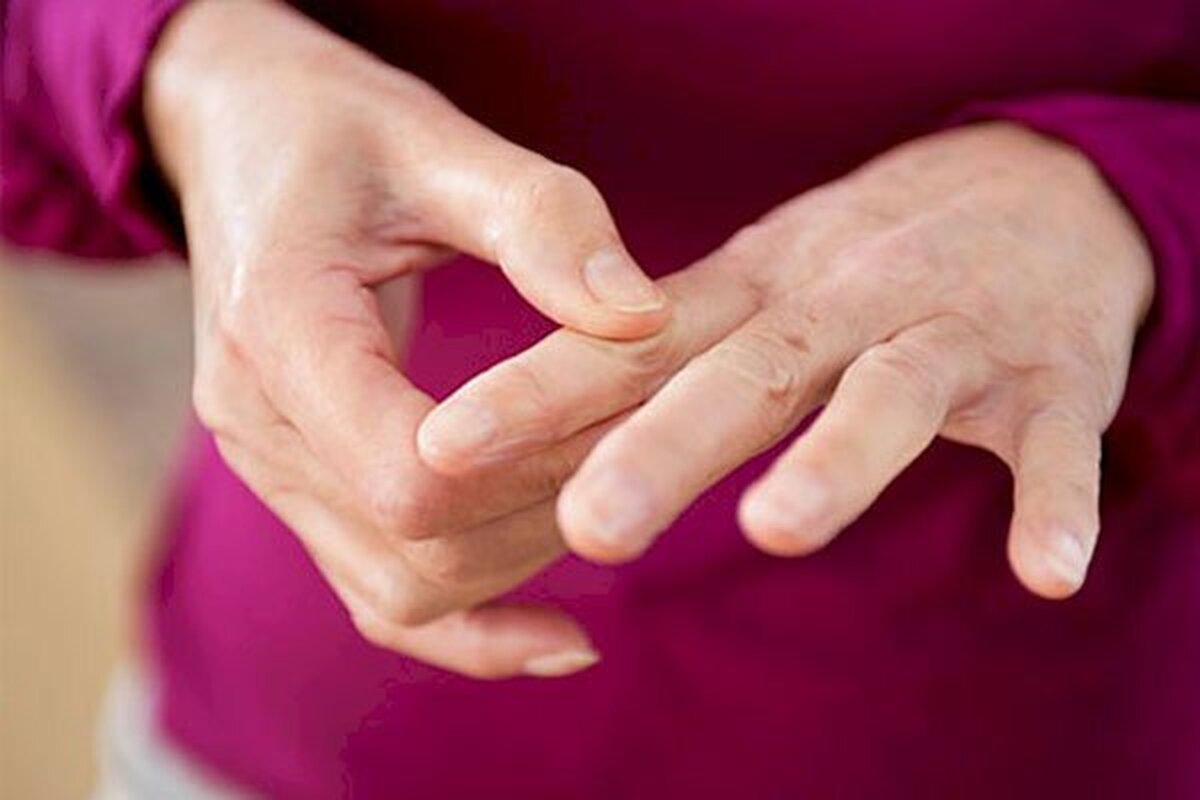 چگونه از بیماری آرتریت روماتوئید با خبر شویم؟