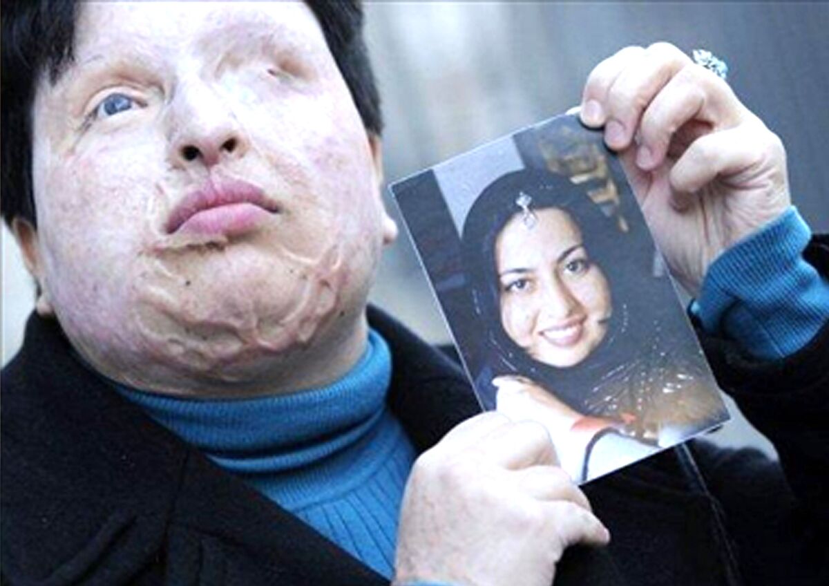 آمنه بهرامی دوباره پیگیر حقش شد