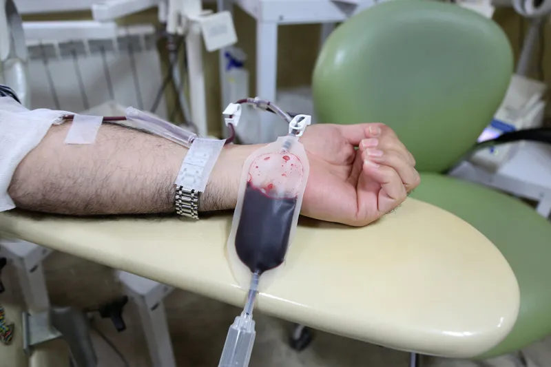 نقش فصد خون در درمان و مدیریت بیماریهای التهابی نقش فصد خون در درمان و مدیریت بیماریهای التهابی