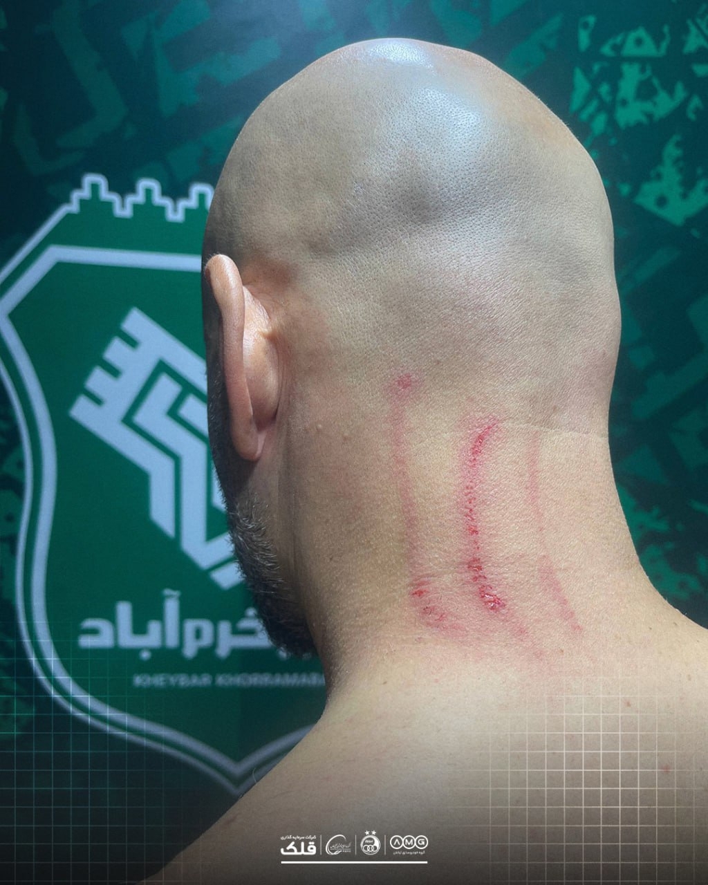 استقلال سند رو کرد؛ جای چنگ روی سر مربی آبیها + عکس استقلال سند رو کرد؛ جای چنگ روی سر مربی آبیها + عکس