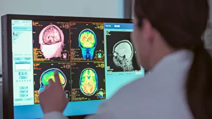 کشف ۴ سن طلایی برای مغز