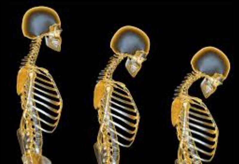 این علائم یعنی استخوان‌های شما در حال پوک شدن است!