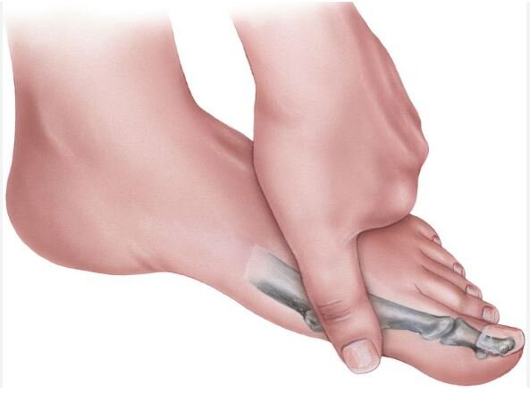 دلایل التهاب مفصلی در انگشتان پا چیست؟