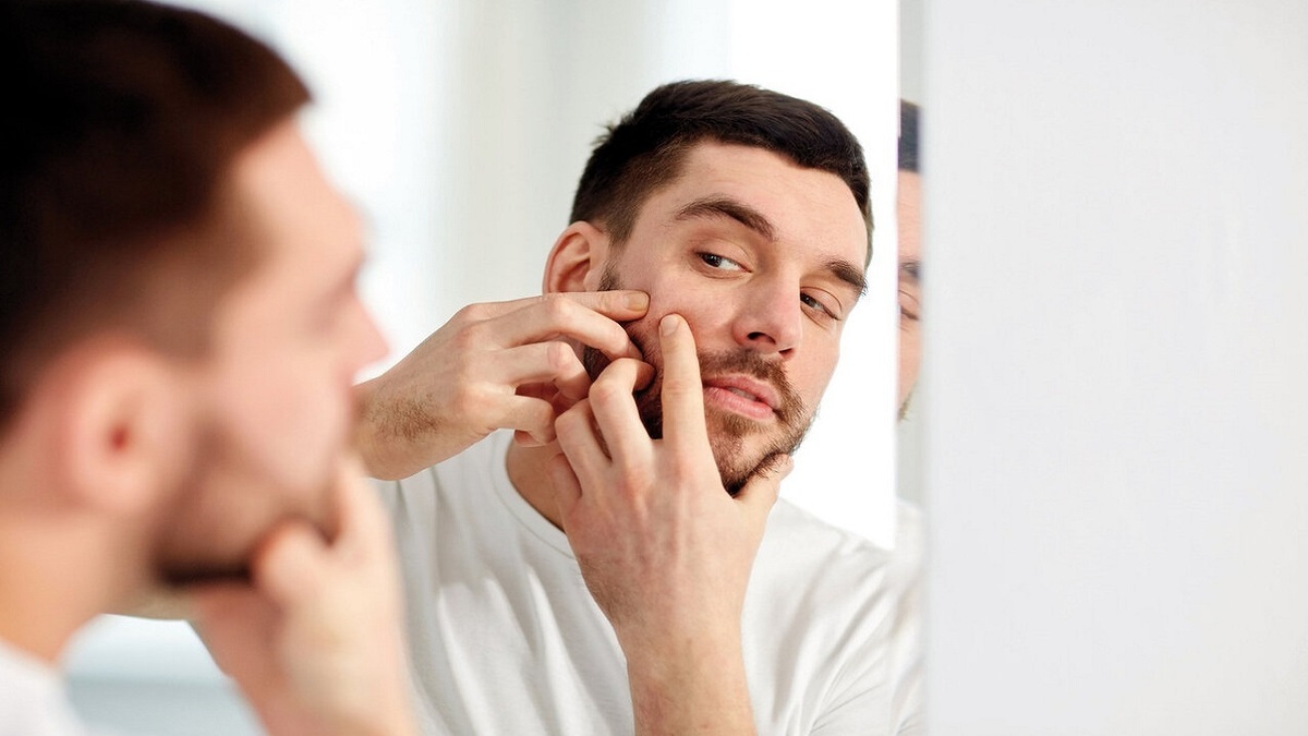 با این ۵ ماده با آکنه خداحافظی کنید