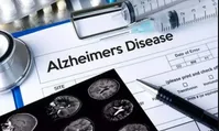 هشدار جدی درباره علائم آلزایمر در جوانی