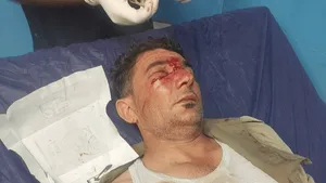 حادثه برای دو محیط‌بان در پارک ملی کرخه