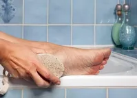 درمان میخچه پا در منزل