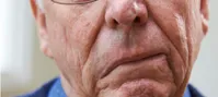 علائم سکته مغزی