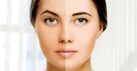 ۶ راه خانگی برای سفید شدن پوست صورت