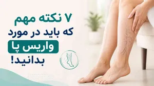 ۷ نکته مهم که باید در مورد واریس پا بدانید!