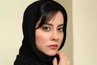 تفاوت عجیب چهره خانم بازیگر قبل از عمل جراحی