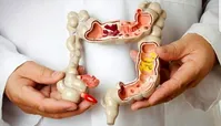 مهمترین عامل مرگ و میر افراد بالای ۵۰ سال