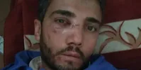 ضرب و شتم تکنسین اورژانس فسا+عکس