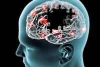 علائم هشدار دهنده بیماری آلزایمر