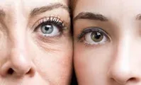 چین و چروک‌ پوست و انواع مختلف آن