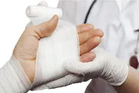 نکات طلایی برای سوختگی