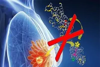 چگونه می‌توان از سرطان سینه در امان بود؟