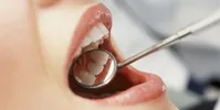 پیشگیری از پوسیدگی دندان با روش طبیعی
