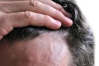 موهایتان را با این ۵ دمنوش گیاهی تقویت کنید!