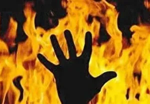 افزایش ۱۸ درصدی تلفات سوختگی در آذربایجان‌شرقی