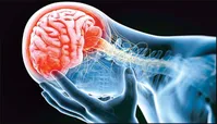 واکسن آنفلوآنزا خطر سکته مغزی را کاهش می‌دهد؟