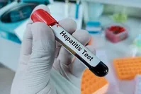 معاون بهداشت وزارت بهداشت: آغاز طرح کنترل هپاتیت B از سال آینده
