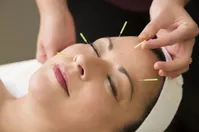 فواید طب سوزنی برای سلامتی