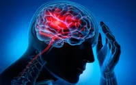 آنچه باید در مورد سکته مغزی بدانید