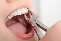وقتی ورزش بر سلامت دندان‌ها تاثیر منفی می‌گذارد!