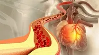 این پنج خوراکی به طور طبیعی کلسترول بد را کاهش می‌دهد