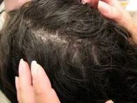 کنترل شوره سر با حمام رفتن منظم