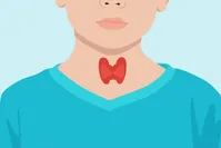 درباره کم کاری تیروئید در کودکان بیشتر بدانیم