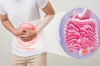 کسانی که استرس دارند دچار این مشکل گوارشی می‌شوند