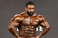 عکس/ هادی چوپان با ظاهری جدید؛ گرگ پارسی در ترکیه مو کاشت!