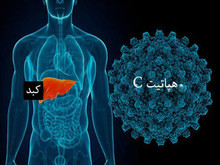 هپاتیت C بیماری خاموش بدون واکسن، اما قابل درمان