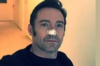حمله سرطان به صورت هیو جکمن