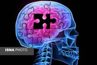 6 فاکتور موثر در پیشرفت آلزایمر