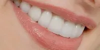 چگونه می‌توان از دندان‌ها مراقبت کرد؟