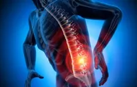 برای تسکین درد سیاتیک از این روش‌ها استفاده کنید