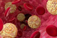 ۱۰علامت نشان‌دهنده کلسترول خون بالا